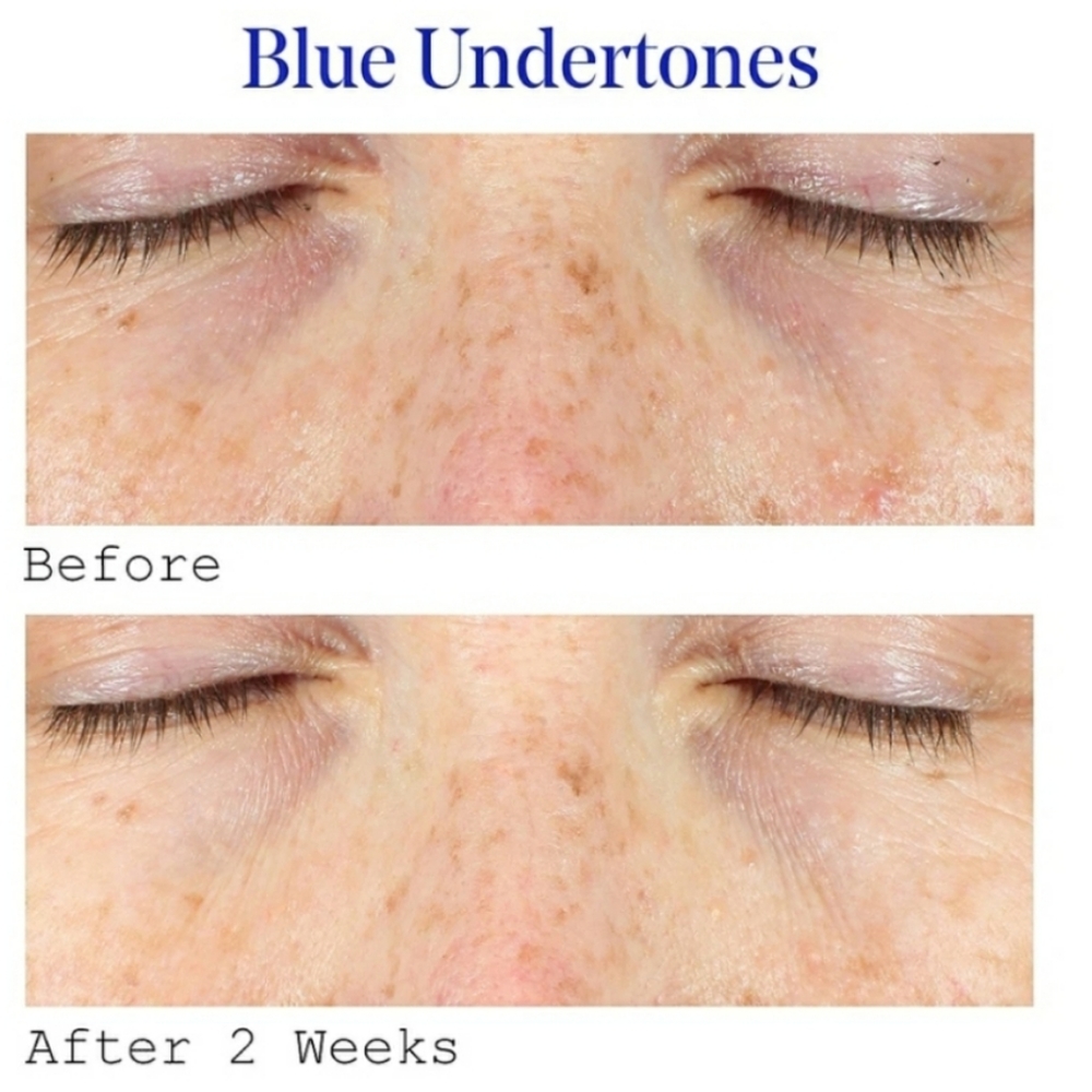 MURAD VITA-C EYES DARK CIRCLE EYE CORRECTOR. - Picture 3 of 7